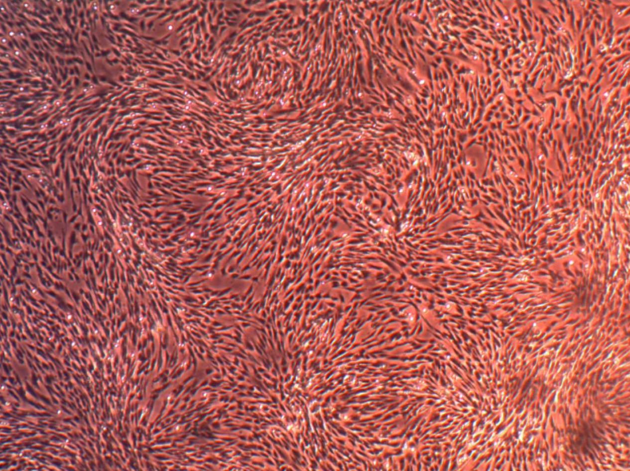 人肾小球系膜细胞（HGMC）