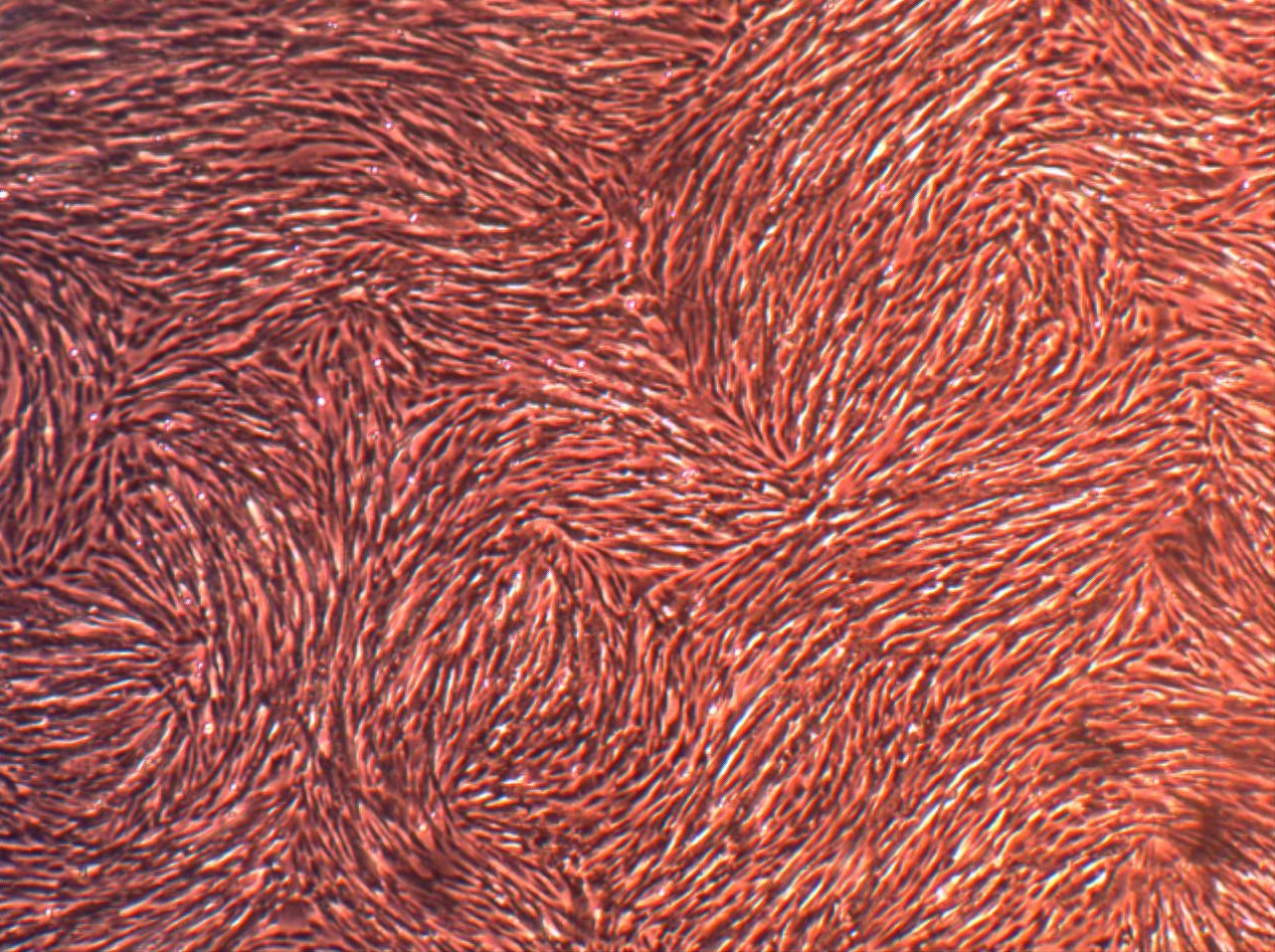 人真皮成纤维细胞（HDF）