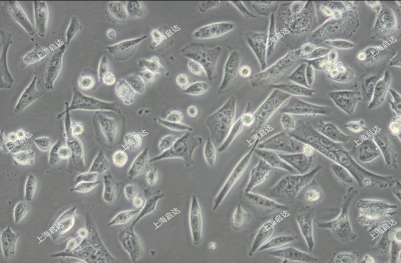 Calu-3人肺腺癌 (胸水)