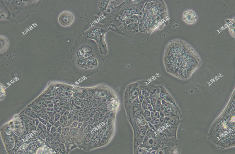 SW 1116人结肠腺癌细胞