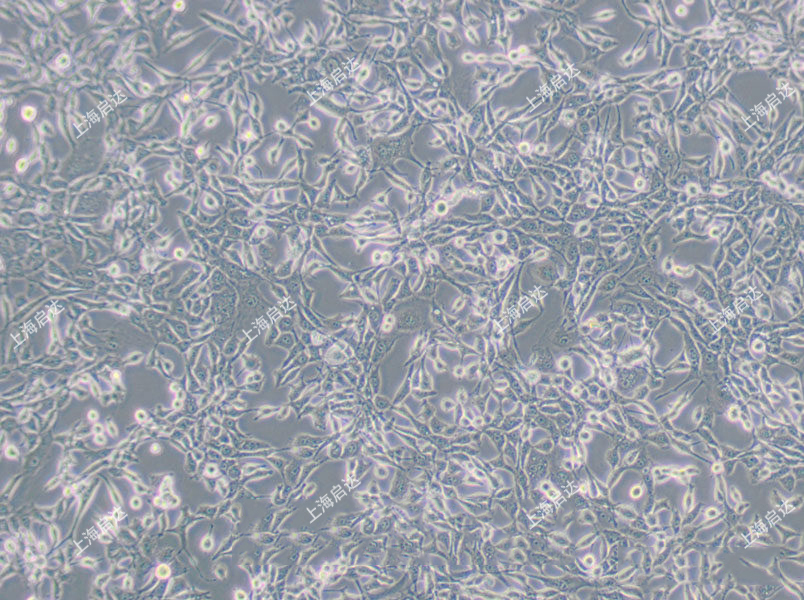 STO小鼠胚胎成纤维细胞