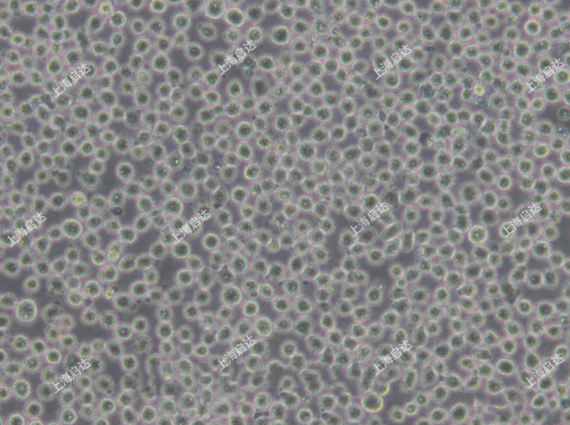 K-562人慢性髓原白血病细胞