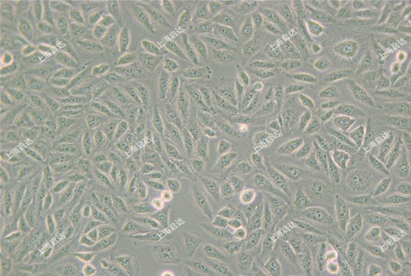 TPC-1 人甲状腺乳头状癌细胞株