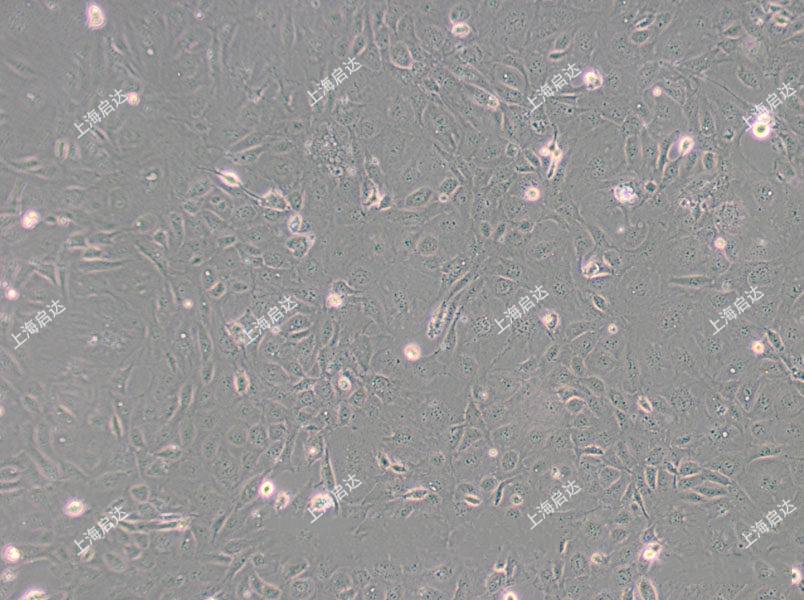 SVEC4-10小鼠淋巴结血管上皮样细胞