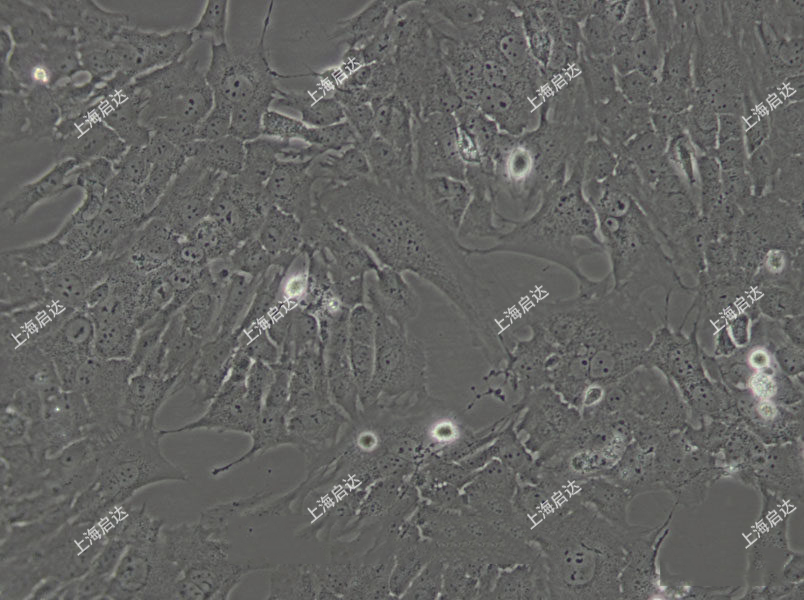 RF/6A猴脉络膜-视网膜(内皮)细胞