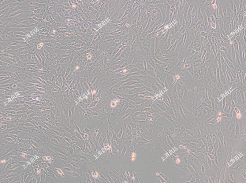 SW 982 [SW-982, SW982]人滑膜肉瘤细胞