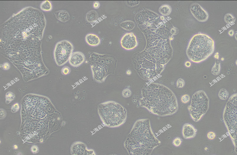 SW 1116人结肠腺癌细胞