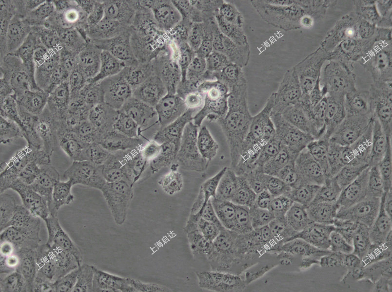 HT-1080 [HT1080]人纤维肉瘤细胞