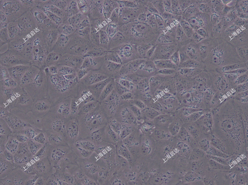 MDCK(NBL-2)狗肾细胞