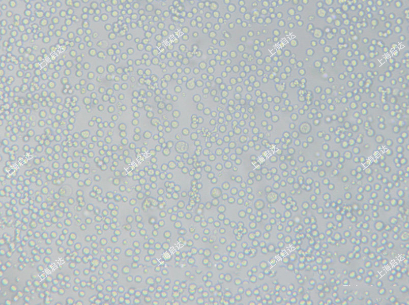 L1210小鼠淋巴细胞白血病 