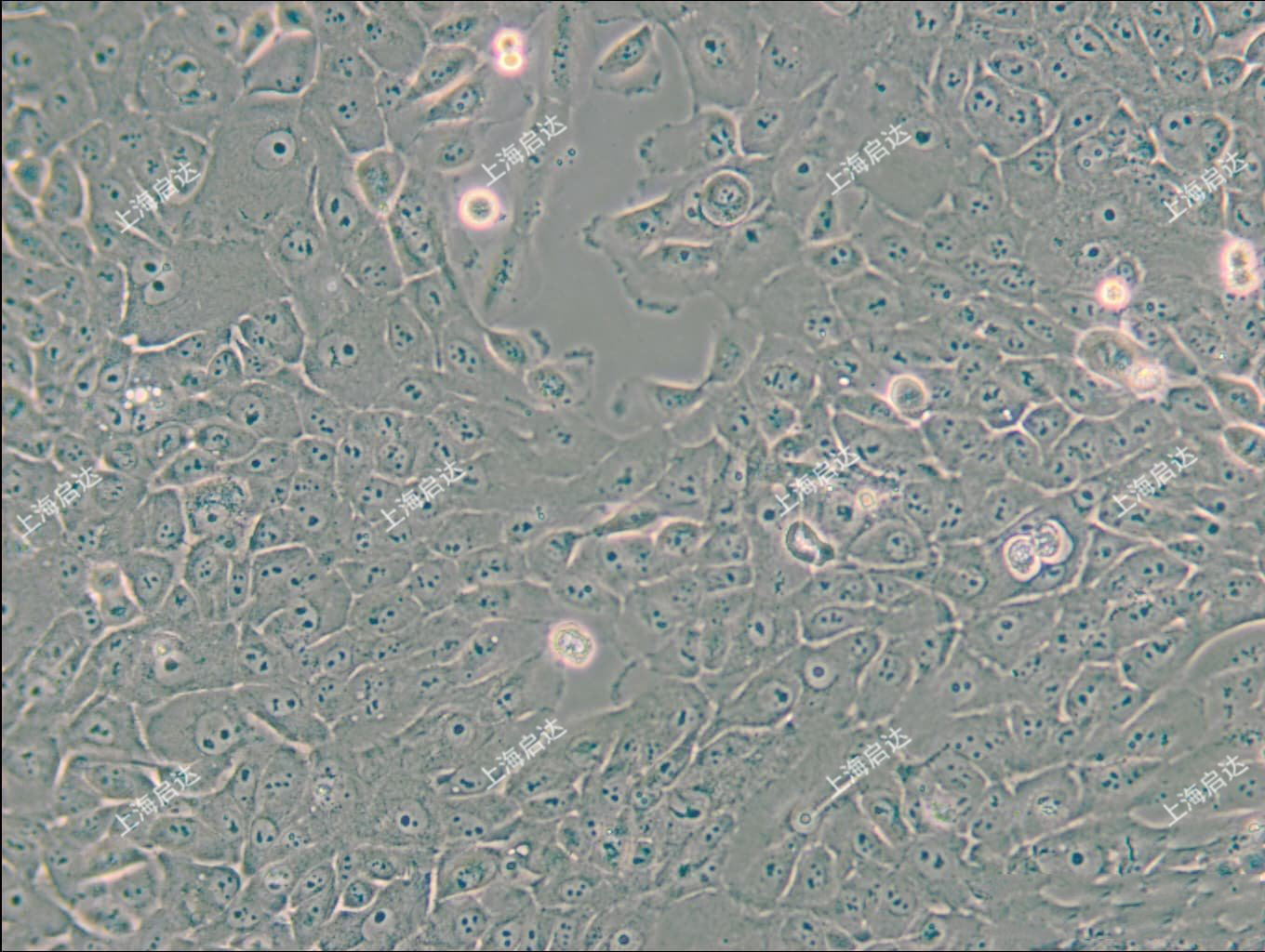 MCF-10A	[MCF 10A]人乳腺上皮细胞