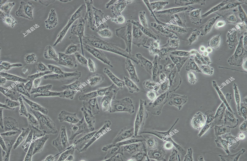 NCI-H1975 [H-1975, H1975]人肺腺癌细胞