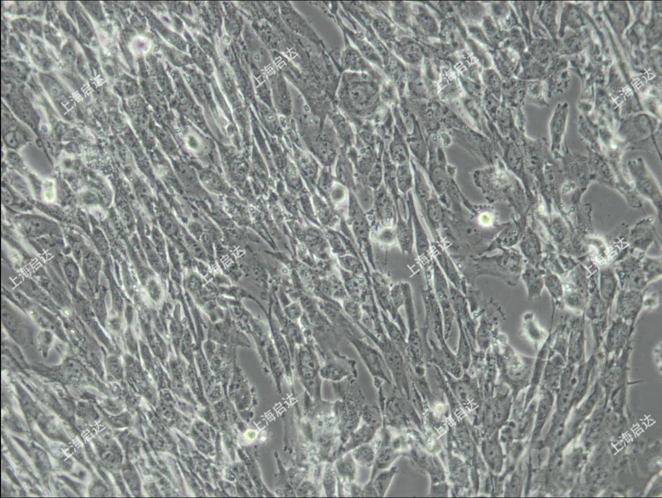 U-118 MG人脑星形胶质母细胞瘤