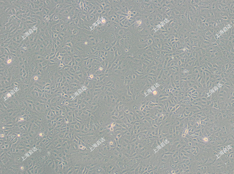 VERO C1008 (E6)非洲绿猴肾细胞