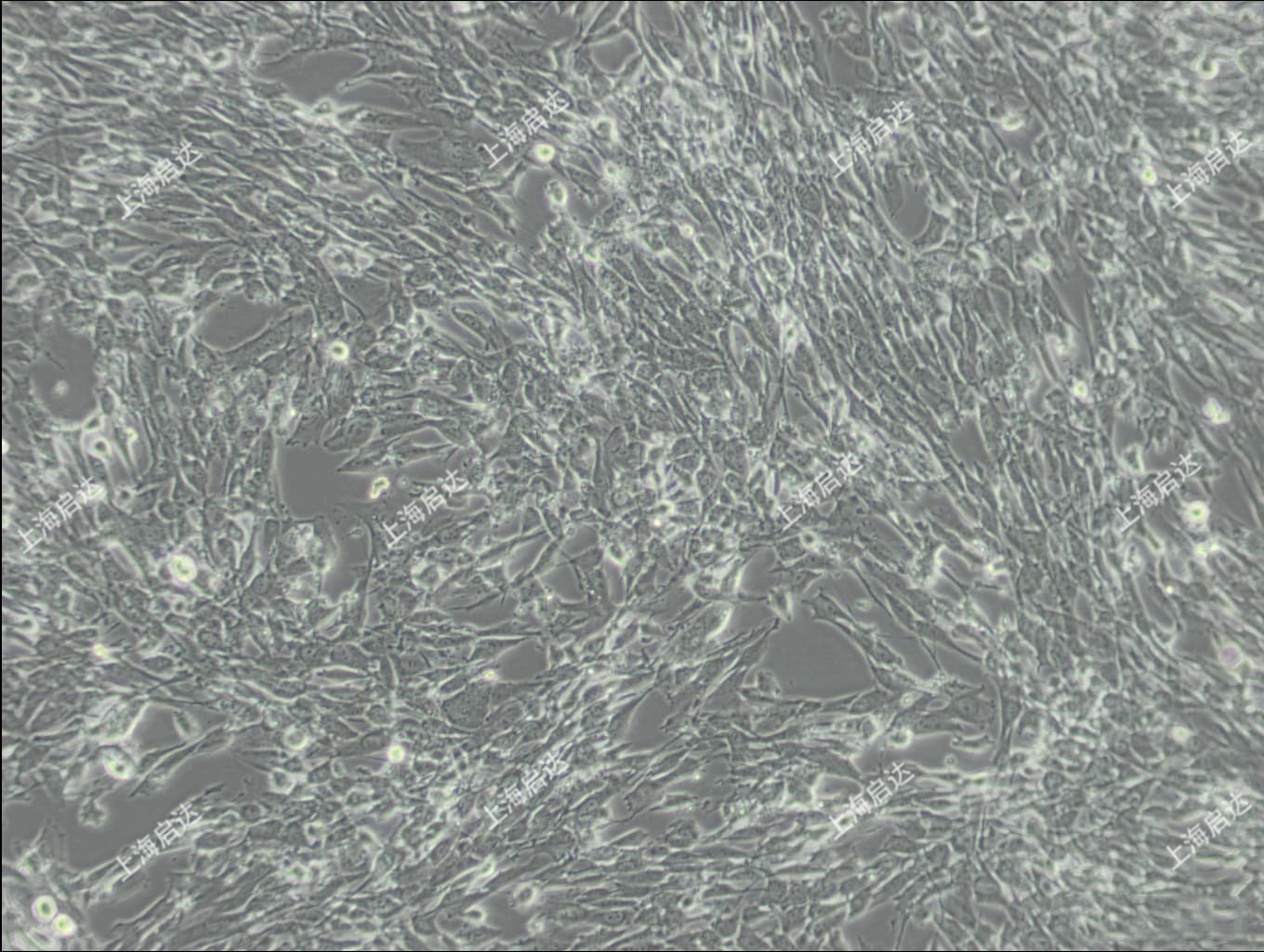 U-118 MG人脑星形胶质母细胞瘤