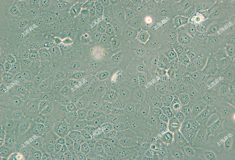 ScaBER人膀胱鳞癌细胞