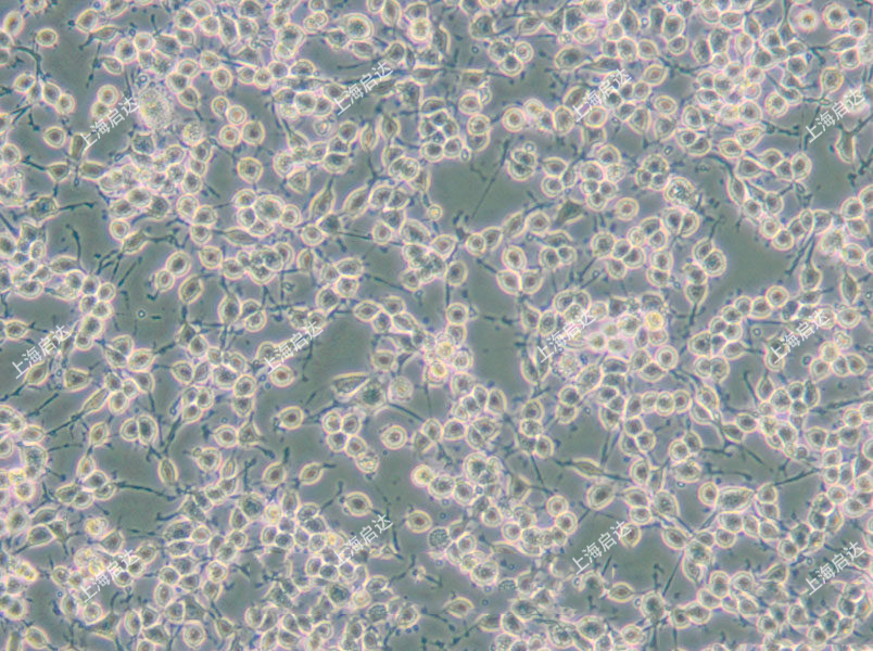 MADB106大鼠乳腺癌细胞
