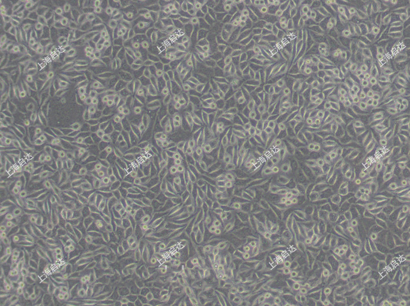 NCTC clone 929 [L cell, L-929, derivative of Strain L]小鼠胚胎成纤维细胞
