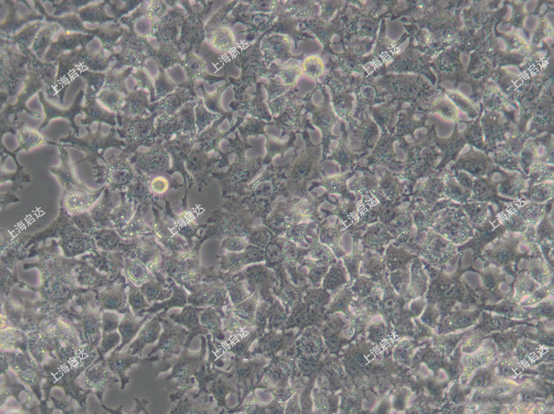 Huh-7人肝癌细胞