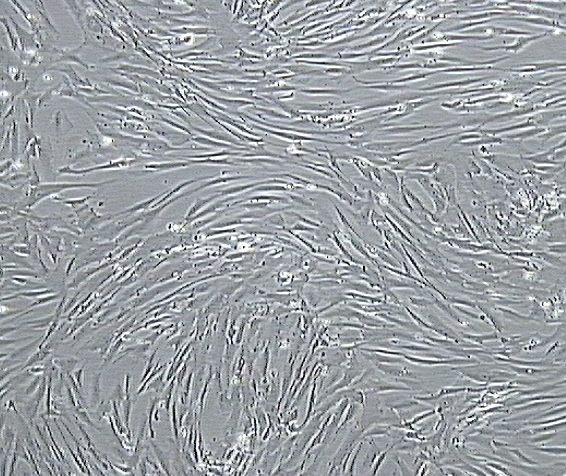 How To Extract Smooth Muscle Cells
