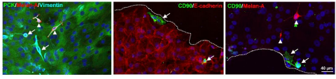 Corneal cell separation