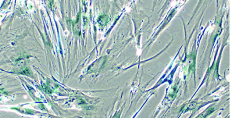 There are many kinds of cell aging tests, depending on which one you choose, let's take a look at mine