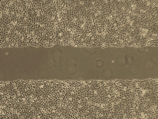 Master these 6 details and the cell scratch experiment was successful once!