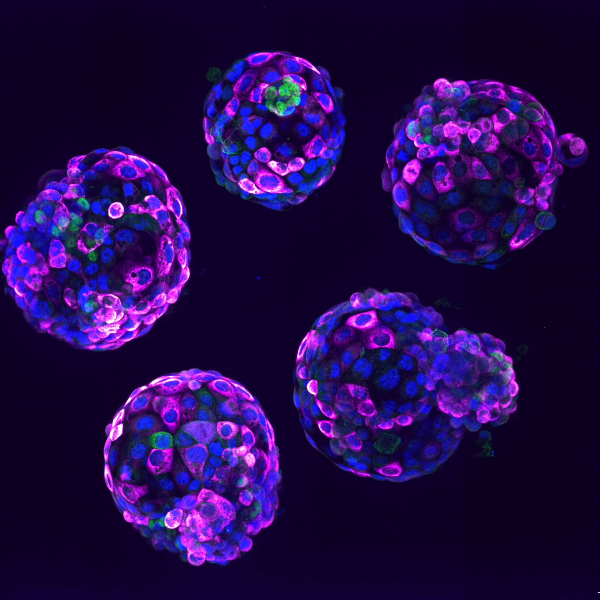 Go Reading,The staining operation of tumor stem cells after they become spherical