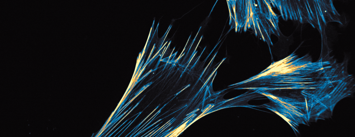 Practical dry goods: Cytoskeleton staining