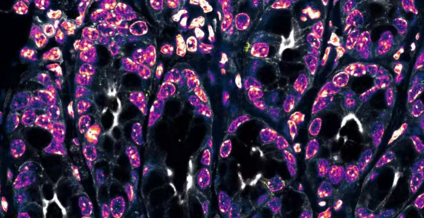 Summary of literature tells you: What to do when encountering cellular vacuoles?