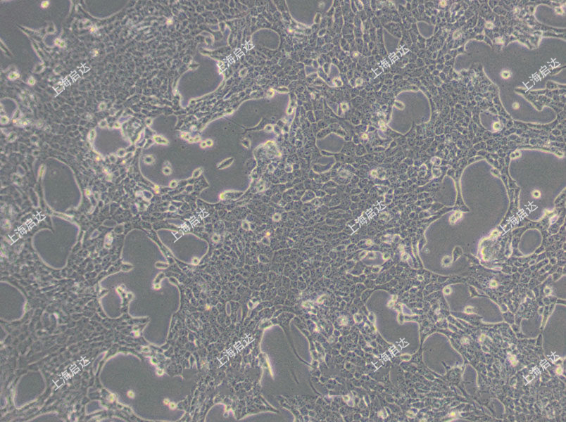 Common EGFR overexpressing cell lines